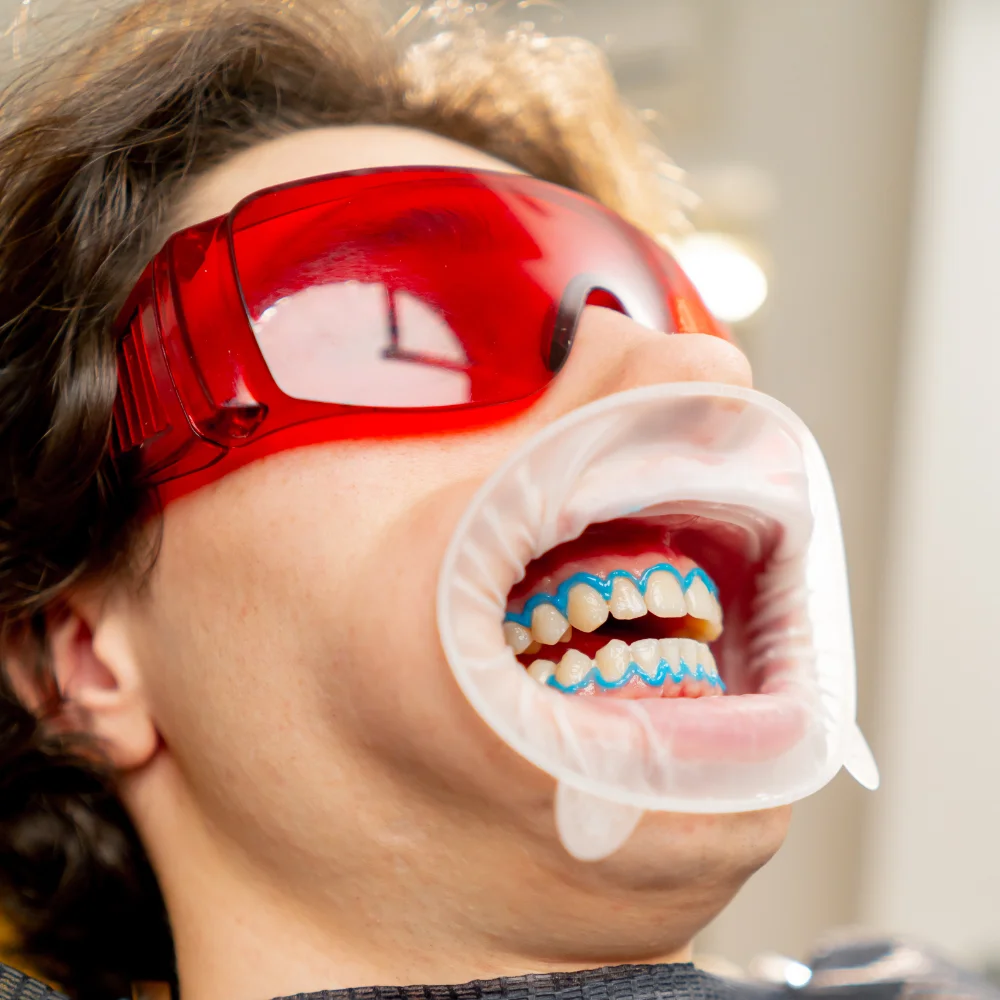 dental-office-guy-sits-during-a-whitening-procedur-RZH6MZL